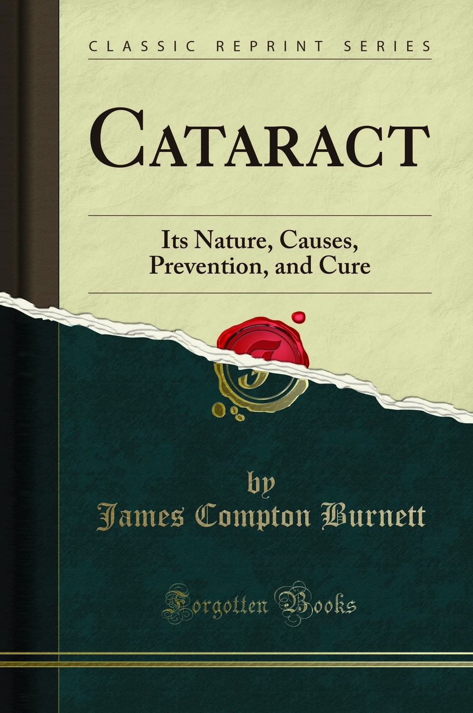 Cataract: Its Nature, Causes, Prevention, and Cure (Classic Reprint)