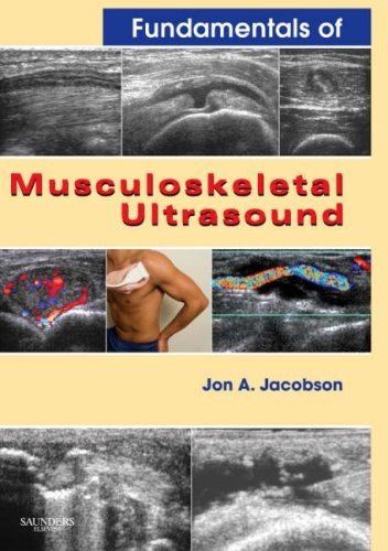 FUNDAMENTALS OF MUSCULOSKELETAL ULTRASOUND (FUNDAMENTALS By Jacobson Jon A. Md