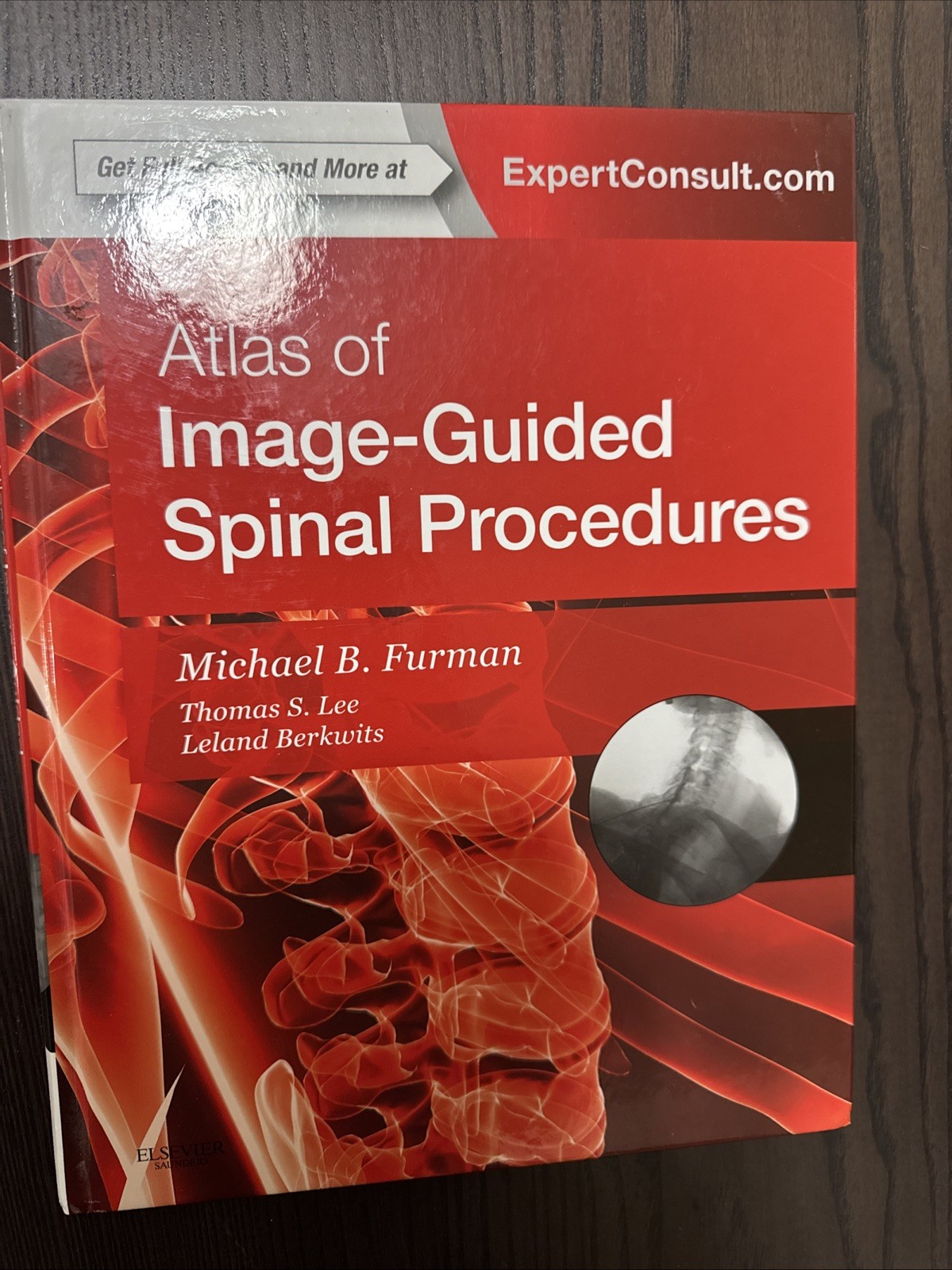 Atlas of Image-Guided Spinal Procedures: Expert Consult – Online and Print