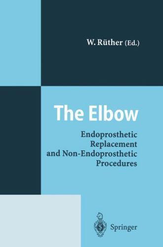 Elbow : Endoprosthetic Replacement and Nonendoprosthetic Procedures, Paperbac…