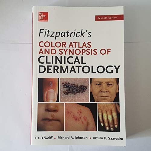 Fitzpatrick's Color Atlas and Synops... by Saavedra, Arturo Paperback / softback