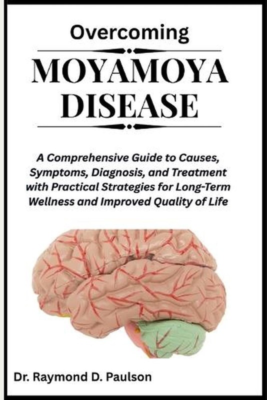 Overcoming Moyamoya Disease: A Comprehensive Guide to Causes, Symptoms, Diagnosi