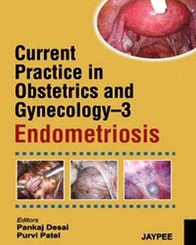 Current Practice in Obstetrics and Gynecology: Endometriosis