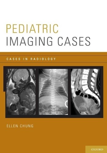 Ellen Chung Pediatric Imaging Cases (Paperback) Cases in Radiology (UK IMPORT)