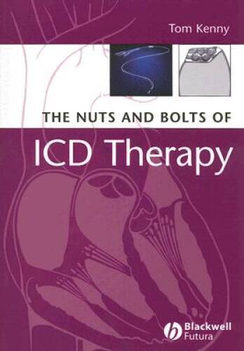 The Nuts and Bolts of ICD Therapy – Paperback By Kenny, Tom – GOOD