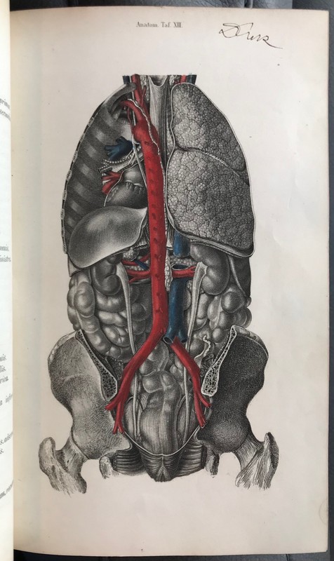 Pitha and Billroth, Handbuch der Igemeinen und speciellen Chirurgie, 1865 gallery