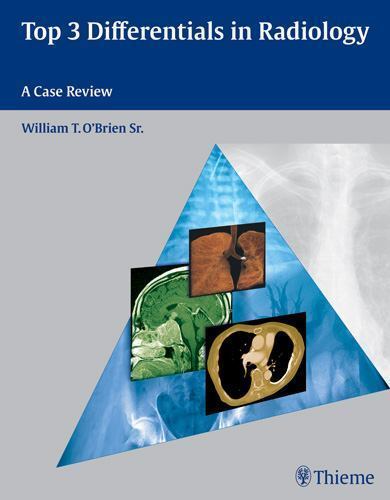 Top 3 Differentials Ser.: Top 3 Differentials in Radiology : Case Review OBrien