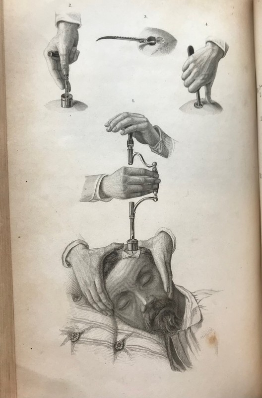 Pitha and Billroth, Handbuch der Igemeinen und speciellen Chirurgie, 1865 gallery