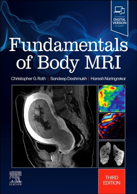 FUNDAMENTALS OF BODY MRI by ROTH, CHRISTOPHER G. Paperback Self Help Business