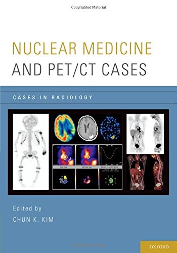 NUCLEAR MEDICINE AND PET/CT CASES (CASES IN RADIOLOGY) By Chun K. Kim