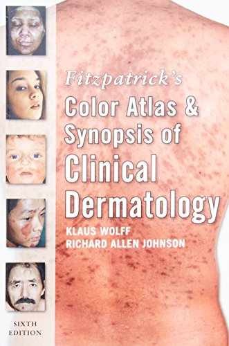 Fitzpatrick’s Color Atlas and – Paperback, by Wolff Klaus; Johnson – Acceptable