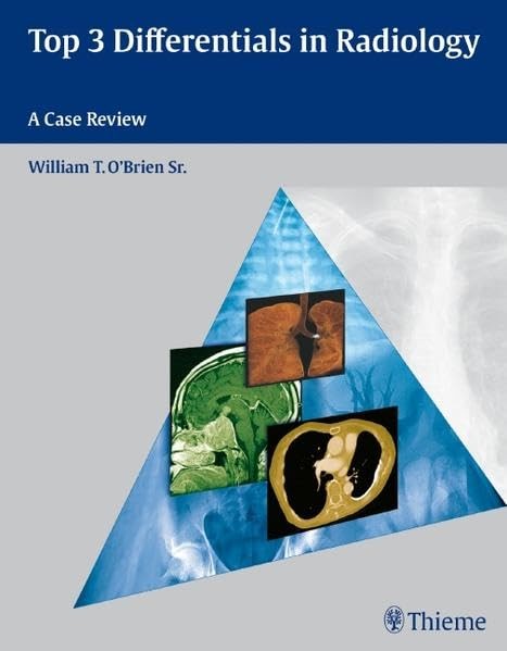 Top 3 Differentials in Radiology: A Case Review by O’Brien