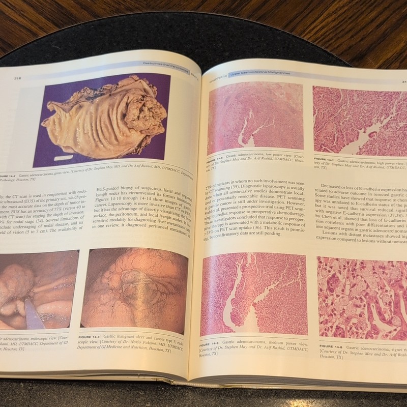 MD Anderson Manual of Medical Oncology Kantarjian 1st Ed Hardcover gallery