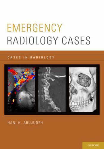 Emergency Radiology Cases, Paperback by Abujudeh, Hani H., M.D., Like New Use...