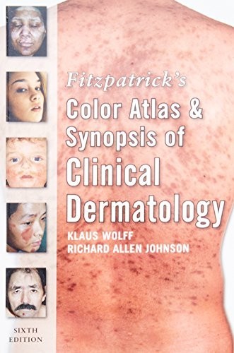 Fitzpatrick’s Color Atlas and Synop…, Johnson, Richar