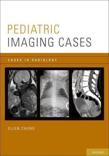 Pediatric Imaging Cases, Paperback by Chung, Ellen, M.D., Brand New, Free shi…