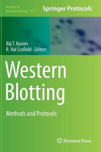 Western Blotting: Methods and Protocols by Biji T Kurien: New