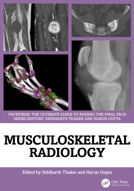 MUSCULOSKELETAL RADIOLOGY by THAKER SIDDHARTH Paperback Self Help Business