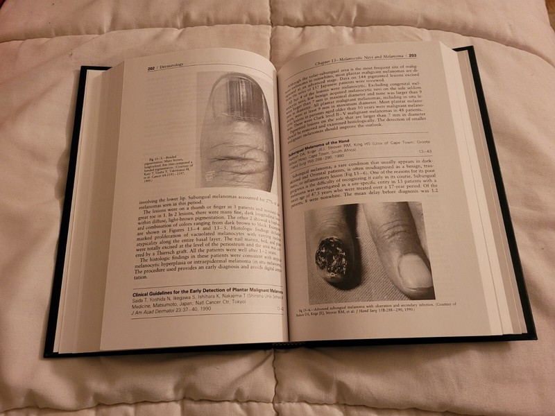 Year Book of Dermatology 1991 By Arthur Sober Thomas Fitzpatrick Hardcover Book gallery