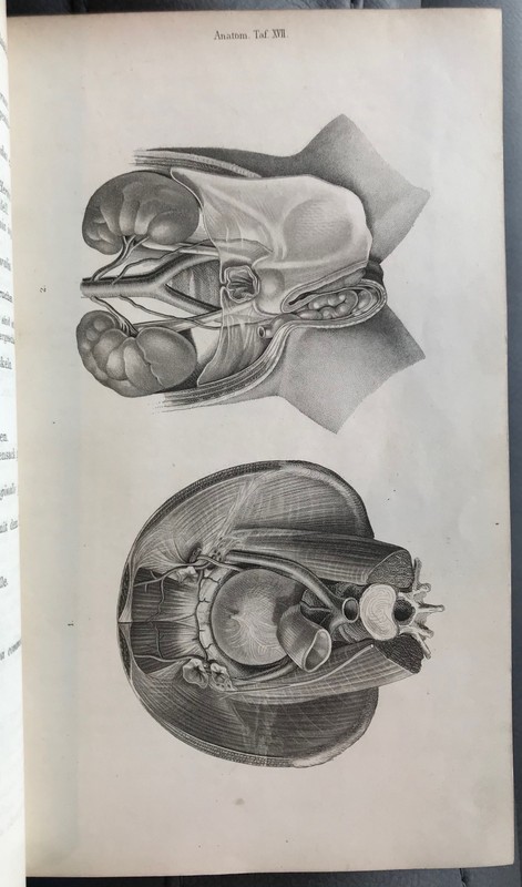 Pitha and Billroth, Handbuch der Igemeinen und speciellen Chirurgie, 1865 gallery