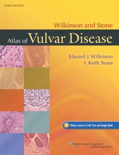 Wilkinson and Stone Atlas of Vulvar Disease, Hardcover by Wilkinson, Edward J…