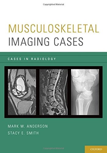 MUSCULOSKELETAL IMAGING CASES (CASES IN RADIOLOGY) By Mark W. Anderson & Stacy